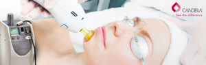 Read more about the article 5 Benefits of Laser Hair Removal