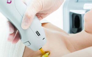 Read more about the article The Benefits of Laser Skin Tightening
