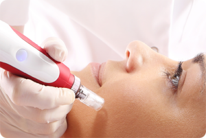 Read more about the article Microneedling: Uses, Risks, & Benefits
